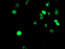 Immunocytochemistry/Immunofluorescence: METT10D Antibody (3B5) [NBP2-02026] - Staining of COS7 cells transiently transfected by pCMV6-ENTRY METT10D.