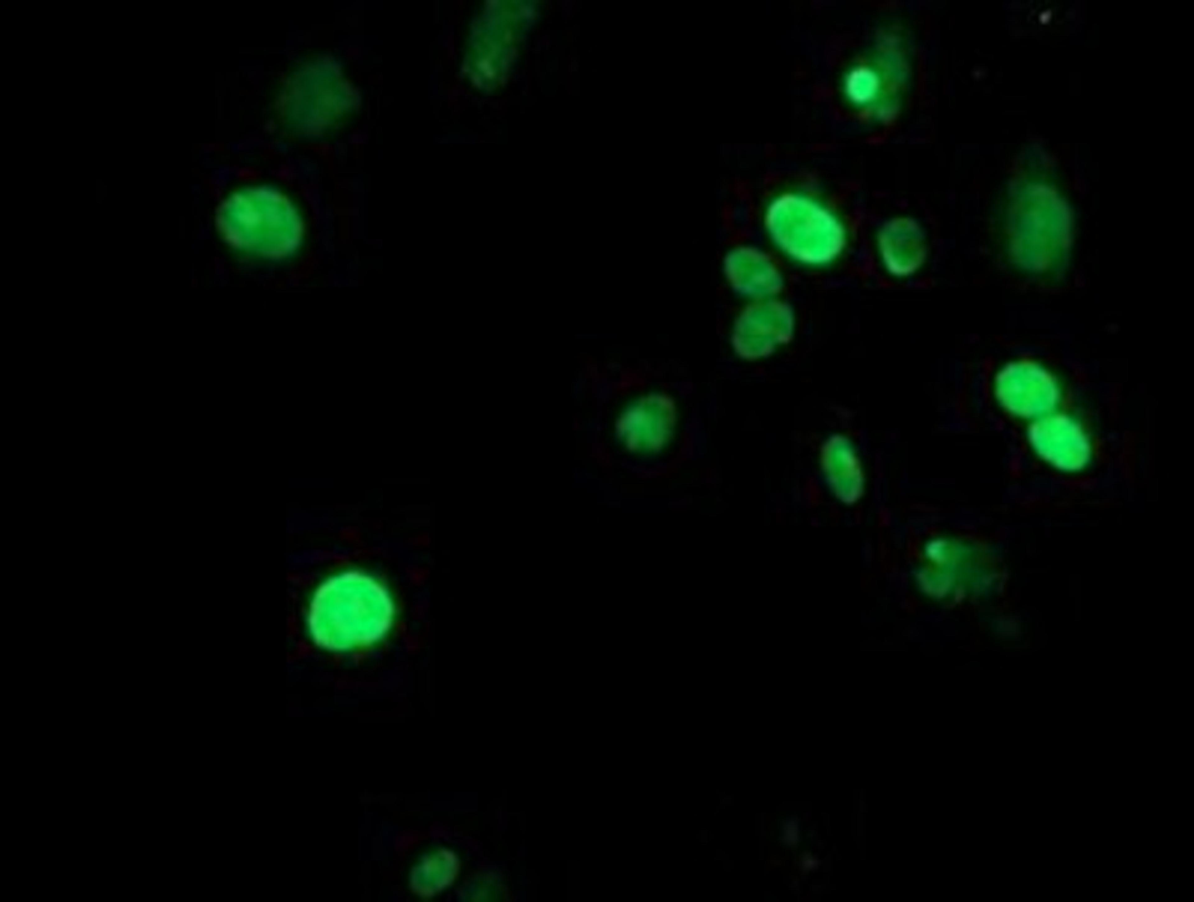 Immunocytochemistry/Immunofluorescence: METT10D Antibody (3B5) [NBP2-02026] - Staining of COS7 cells transiently transfected by pCMV6-ENTRY METT10D.