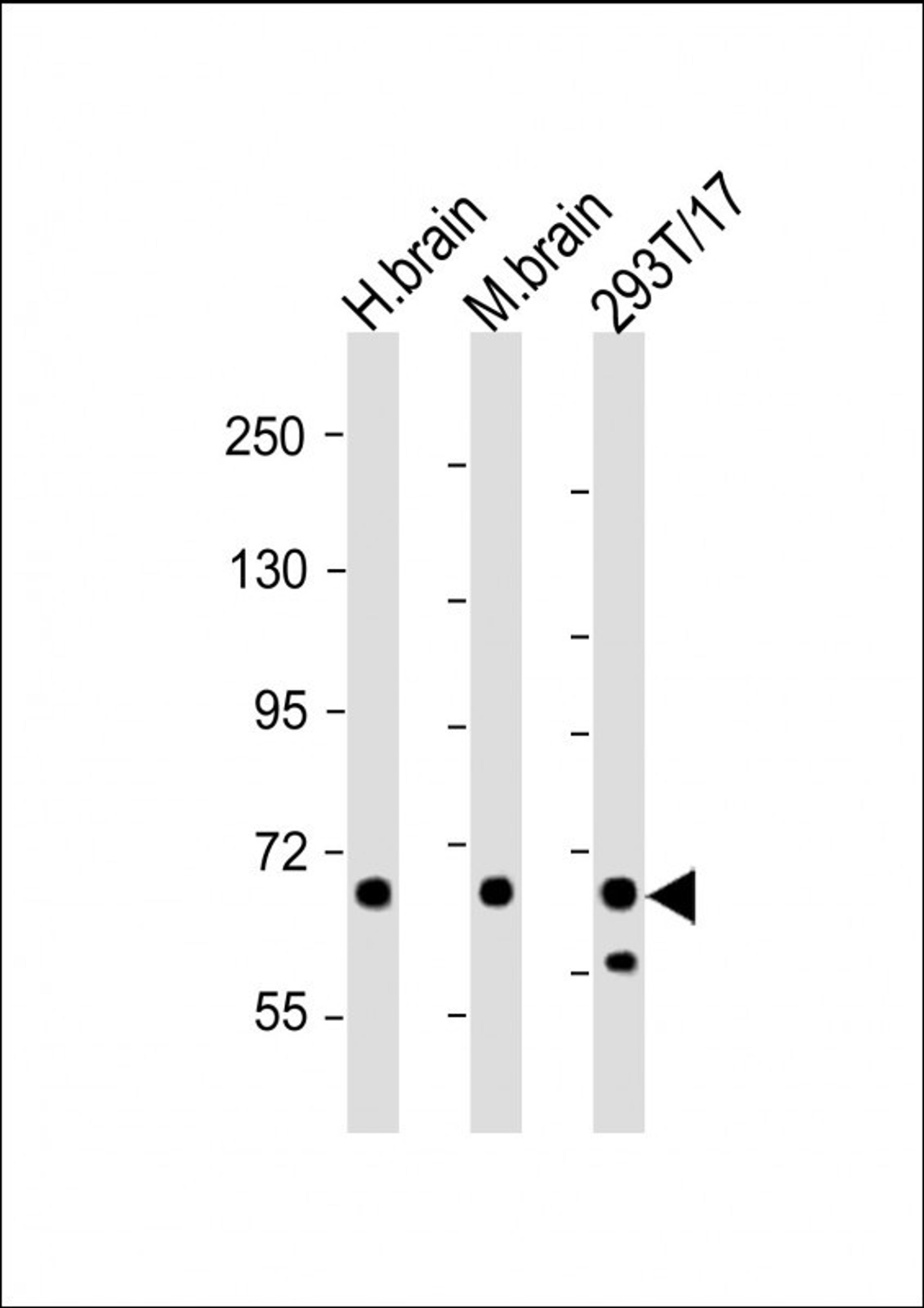 Western Blot at 1:2000 dilution Lane 1: human brain lysate Lane 2: mouse brain lysate Lane 3: 293T/17 whole cell lysate Lysates/proteins at 20 ug per lane.