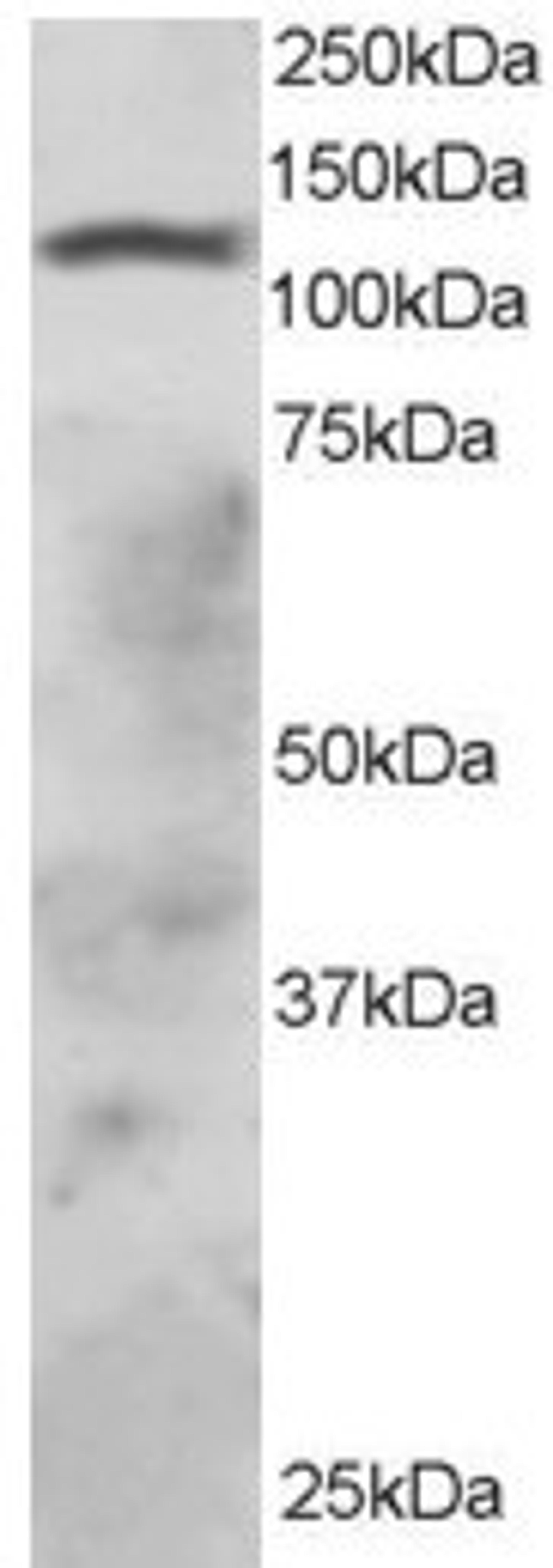 46-612 staining (2ug/ml) of HepG2 lysate (RIPA buffer, 30ug total protein per lane). Primary incubated for 1 hour. Detected by chemiluminescence.