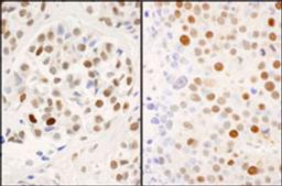 Detection of human and mouse Phospho MCM2 (S53) by immunohistochemistry.