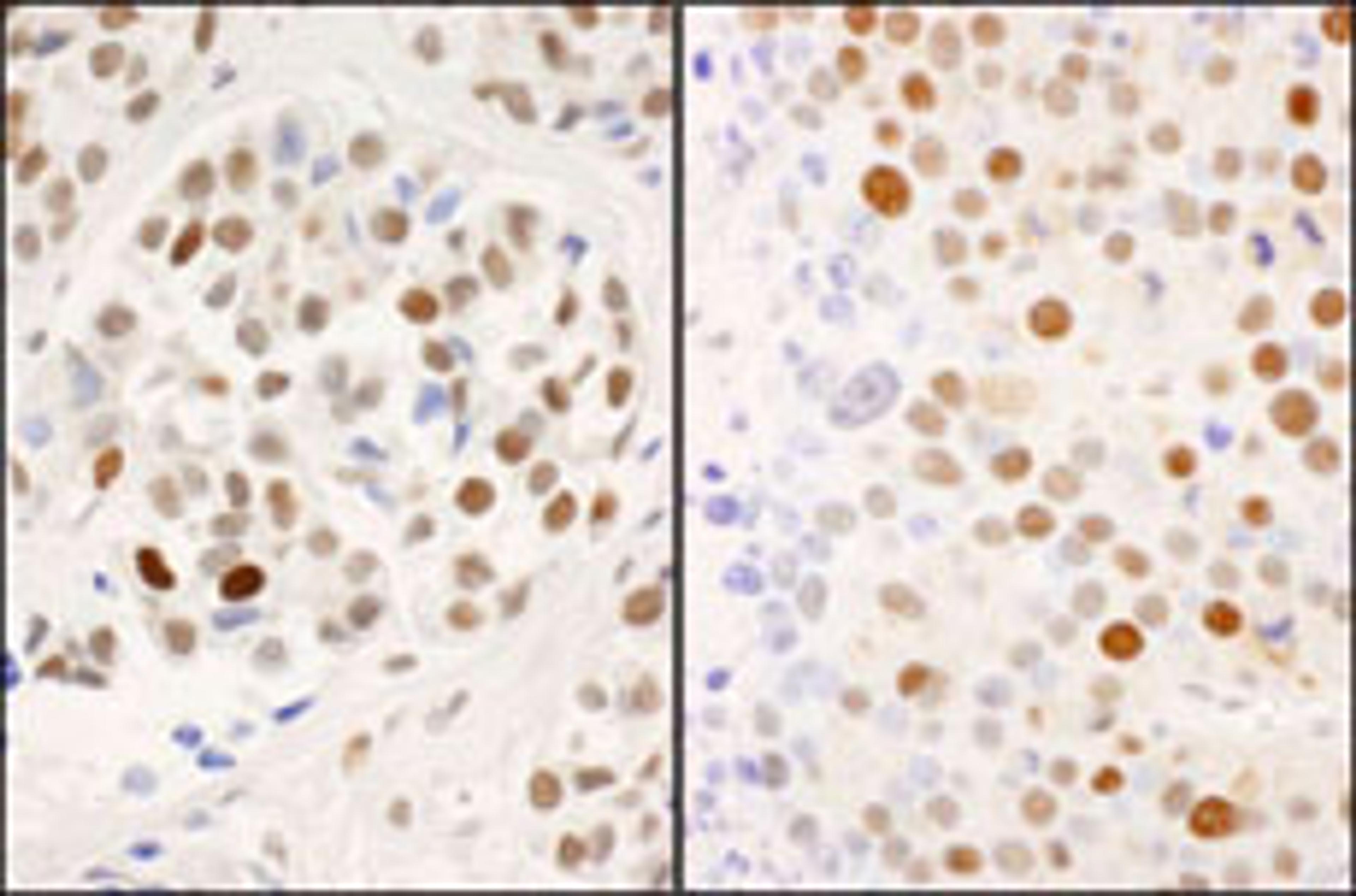 Detection of human and mouse Phospho MCM2 (S53) by immunohistochemistry.