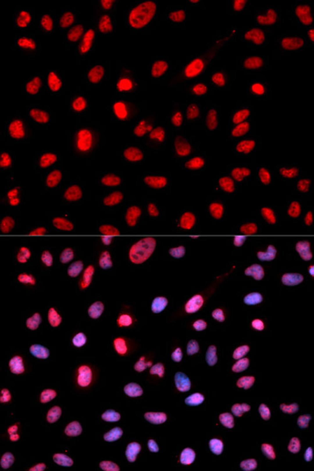 Immunofluorescence - Phospho-Dnmt1-pS714 antibody (AP0021)