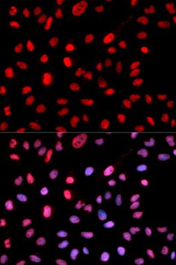 Immunofluorescence - Phospho-Dnmt1-pS714 antibody (AP0021)