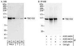 Detection of human TBC1D2 by western blot and immunoprecipitation.