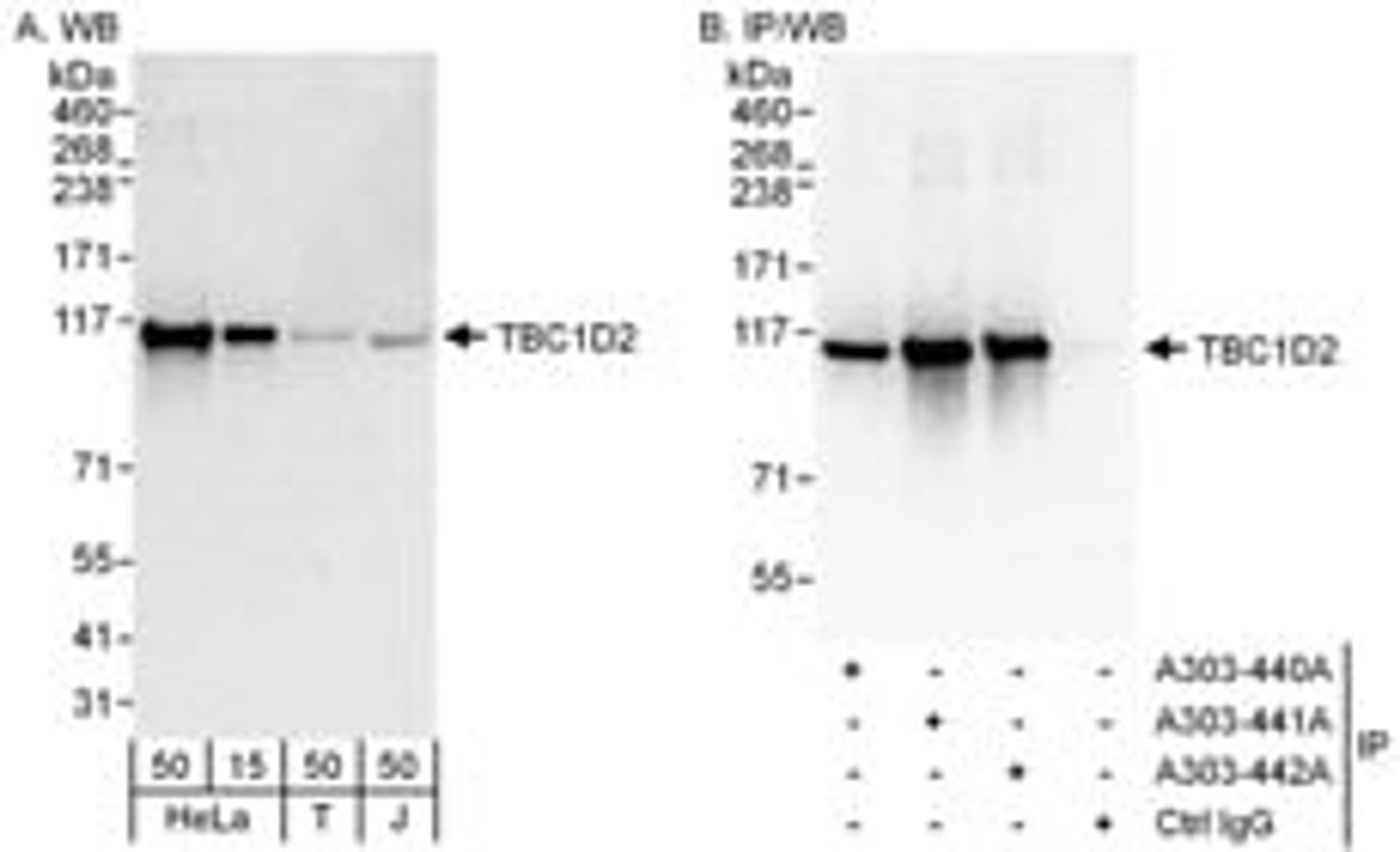 Detection of human TBC1D2 by western blot and immunoprecipitation.