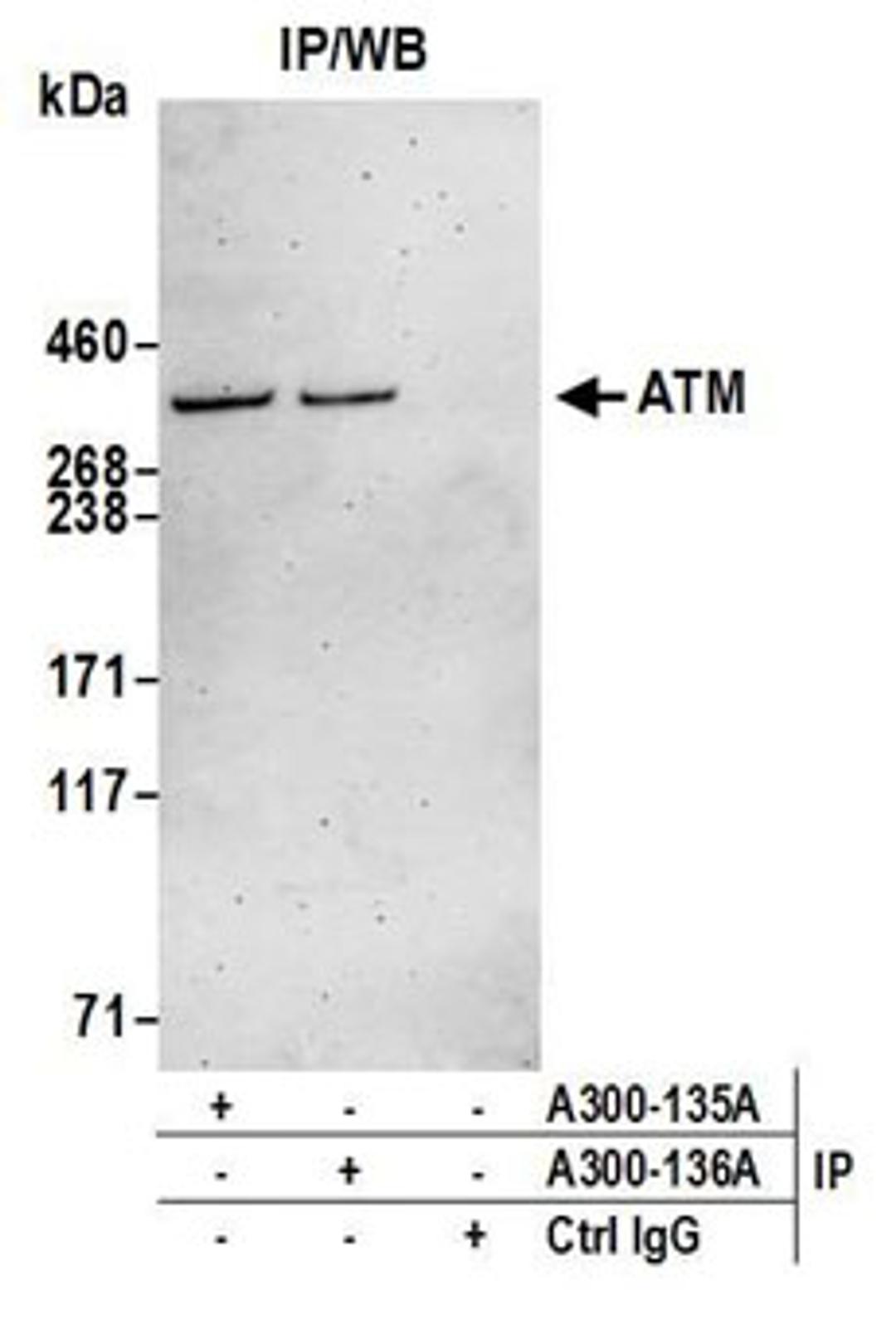 Detection of human ATM by western blot of immunoprecipitates.