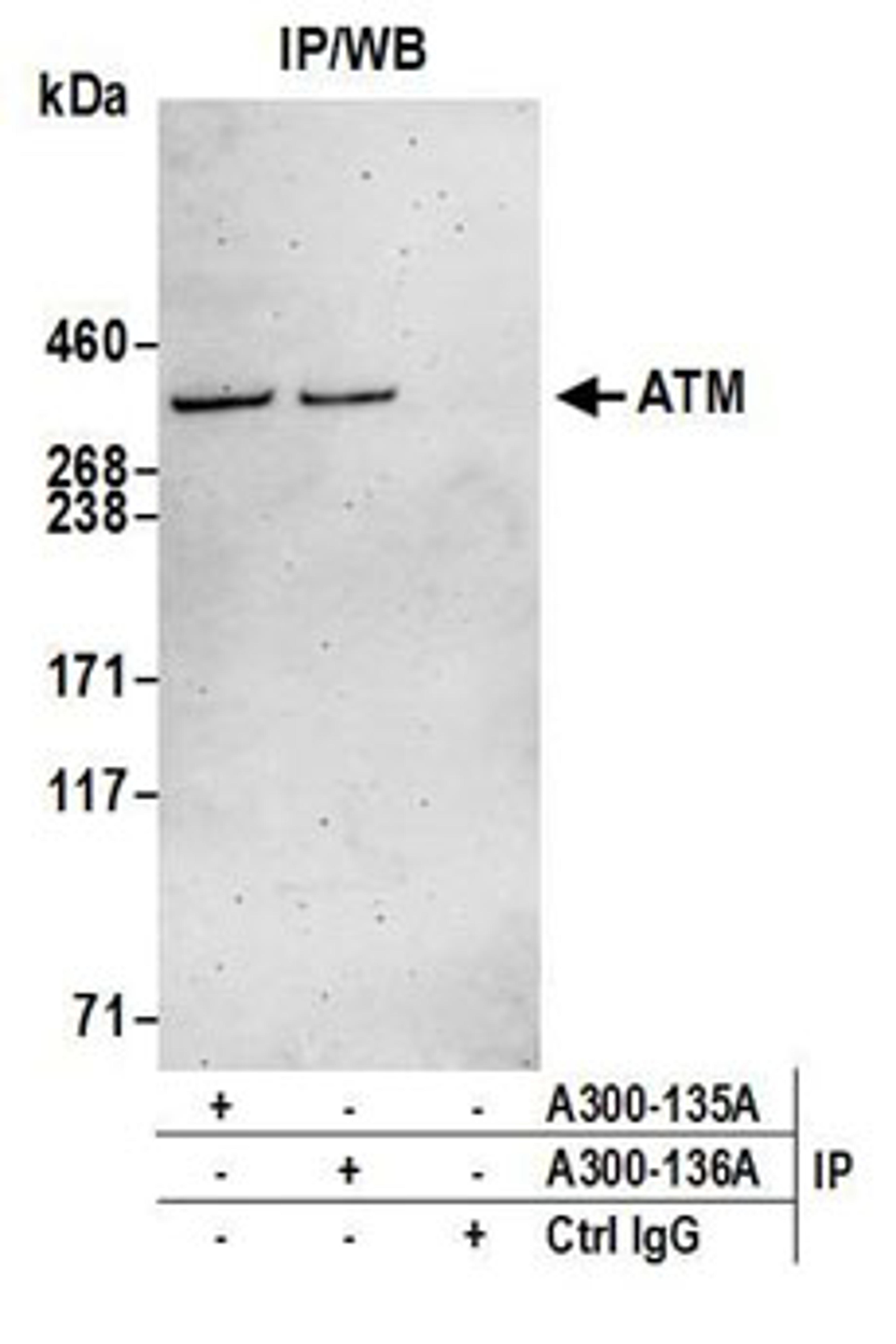 Detection of human ATM by western blot of immunoprecipitates.