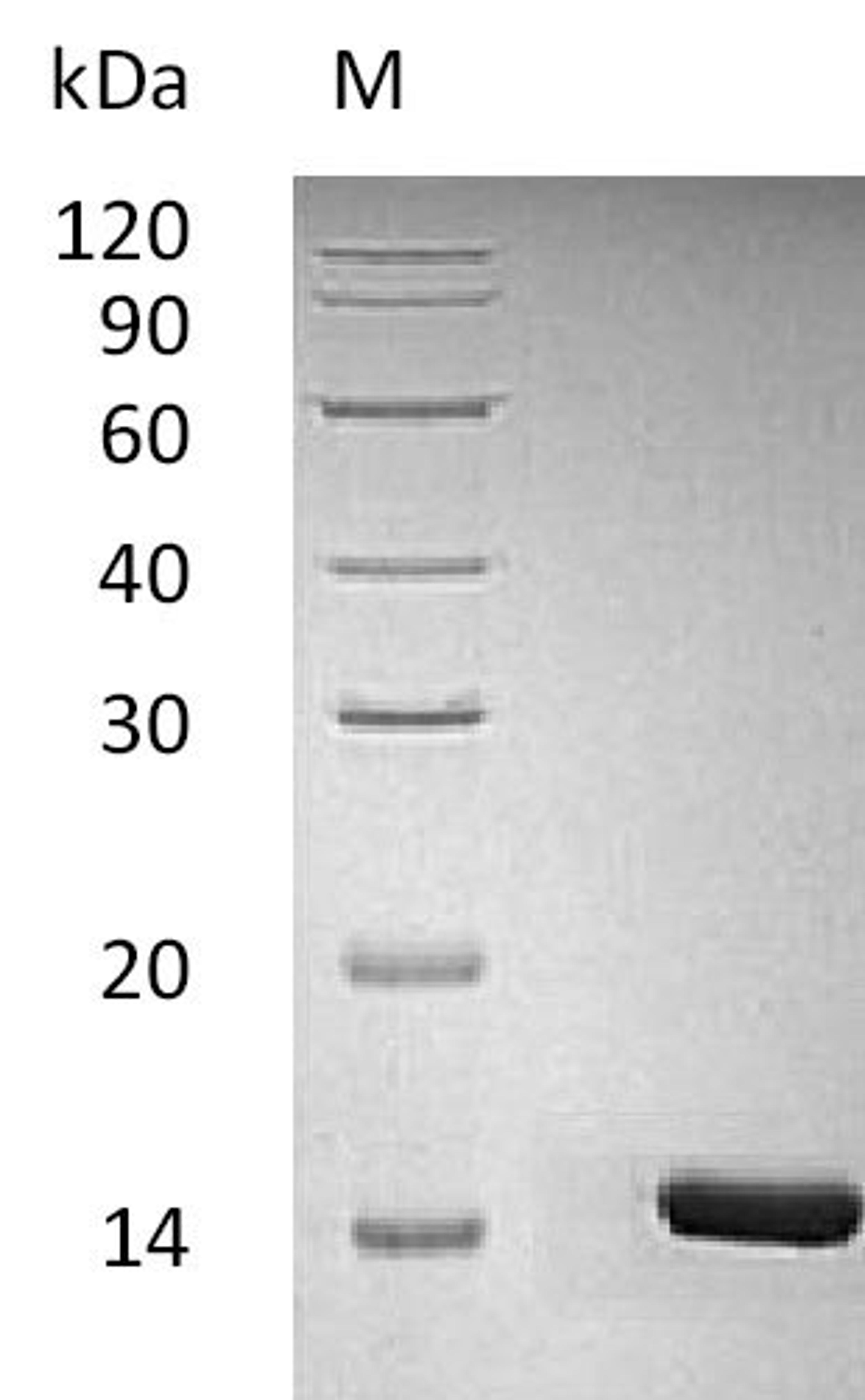 (Tris-Glycine gel) Discontinuous SDS-PAGE (reduced) with 5% enrichment gel and 15% separation gel.