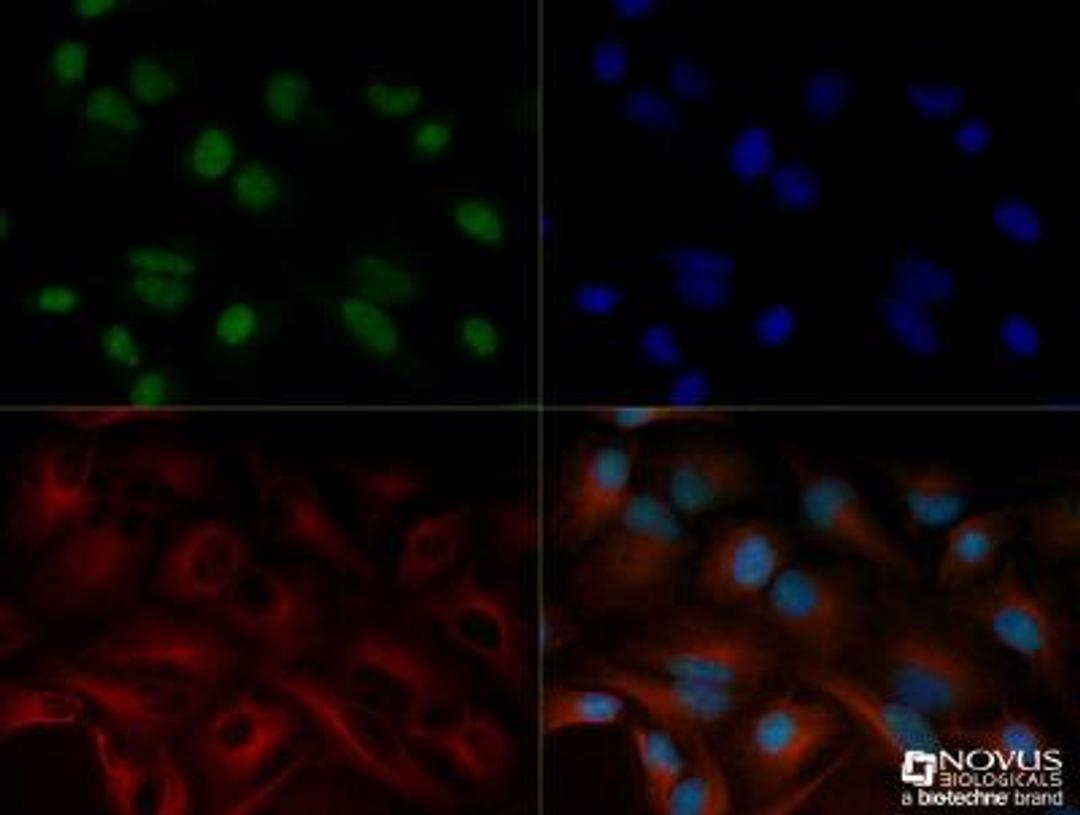 Immunocytochemistry/Immunofluorescence: Snail Antibody [NBP2-27184] - HeLa cells were fixed for 10 minutes using 10% formalin and then permeabilized for 5 minutes using 1X TBS + 0.5% Triton-X100. The cells were incubated with SNAIL (NBP2-27184) at a 1:100 dilution overnight at 4 degrees Celsius and detected with Dylight 488 (Green) at a 1:500 dilution. Alpha tubulin was used as a co-stain at a 1:1000 dilution and detected with Dylight 550 (Red). Nuclei were detected with DAPI (Blue) at 2.0 ug/ml in 1X PBS. Cells were imaged using a 40X objective.