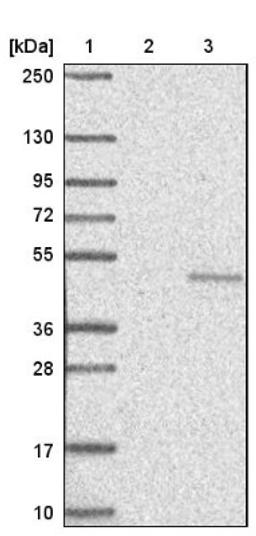 Western Blot: Natriuretic Peptide Receptor B Antibody [NBP1-82538] - Lane 1: Marker [kDa] 250, 130, 95, 72, 55, 36, 28, 17, 10<br/>Lane 2: Negative control (vector only transfected HEK293T lysate)<br/>Lane 3: Over-expression lysate (Co-expressed with a C-terminal myc-DDK tag (~3.1 kDa) in mammalian HEK293T cells, LY416577)