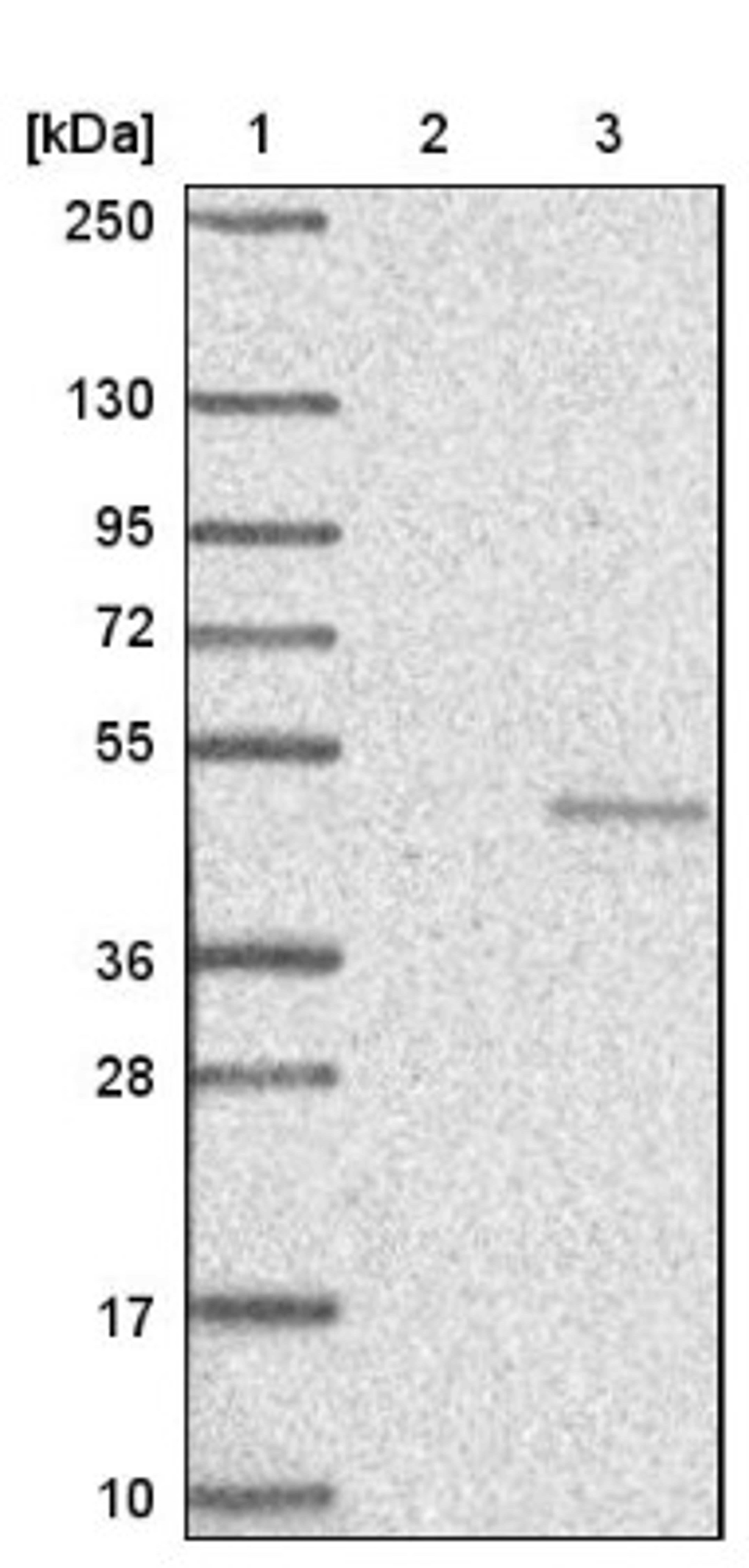 Western Blot: Natriuretic Peptide Receptor B Antibody [NBP1-82538] - Lane 1: Marker [kDa] 250, 130, 95, 72, 55, 36, 28, 17, 10<br/>Lane 2: Negative control (vector only transfected HEK293T lysate)<br/>Lane 3: Over-expression lysate (Co-expressed with a C-terminal myc-DDK tag (~3.1 kDa) in mammalian HEK293T cells, LY416577)