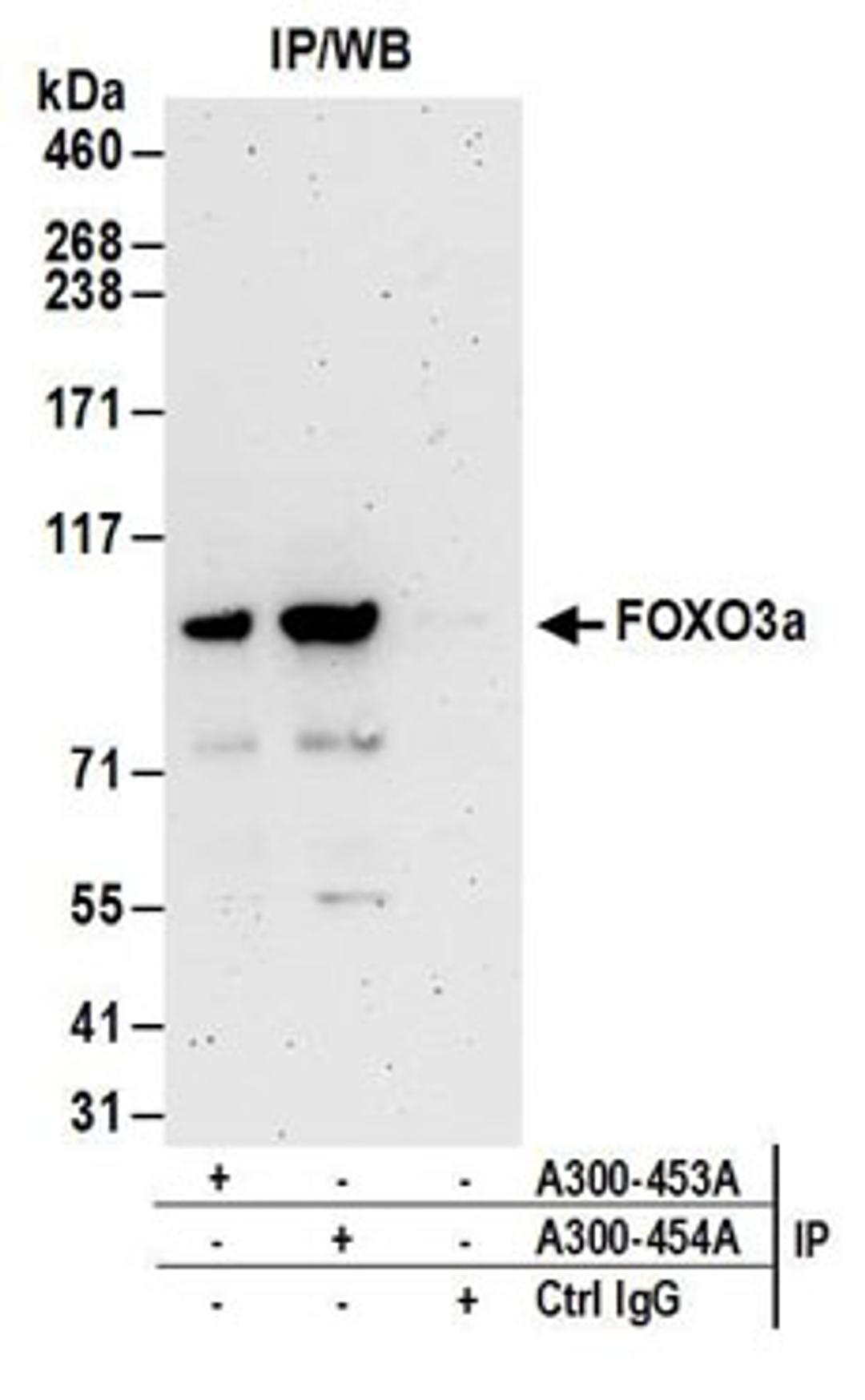 Detection of human FOXO3a by western blot of immunoprecipitates.