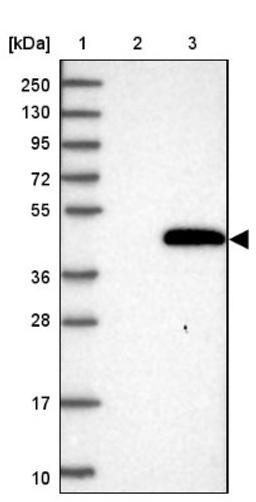 Western Blot: FANK1 Antibody [NBP2-32686] - Lane 1: Marker [kDa] 250, 130, 95, 72, 55, 36, 28, 17, 10<br/>Lane 2: Negative control (vector only transfected HEK293T lysate)<br/>Lane 3: Over-expression lysate (Co-expressed with a C-terminal myc-DDK tag (~3.1 kDa) in mammalian HEK293T cells, LY407972)