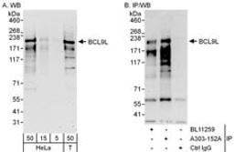 Detection of human BCL9L by western blot and immunoprecipitation.