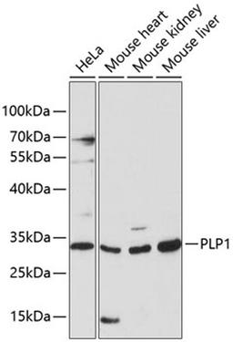 Western blot - PLP1 antibody (A14251)