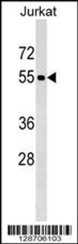 Western blot analysis in Jurkat cell line lysates (35ug/lane).