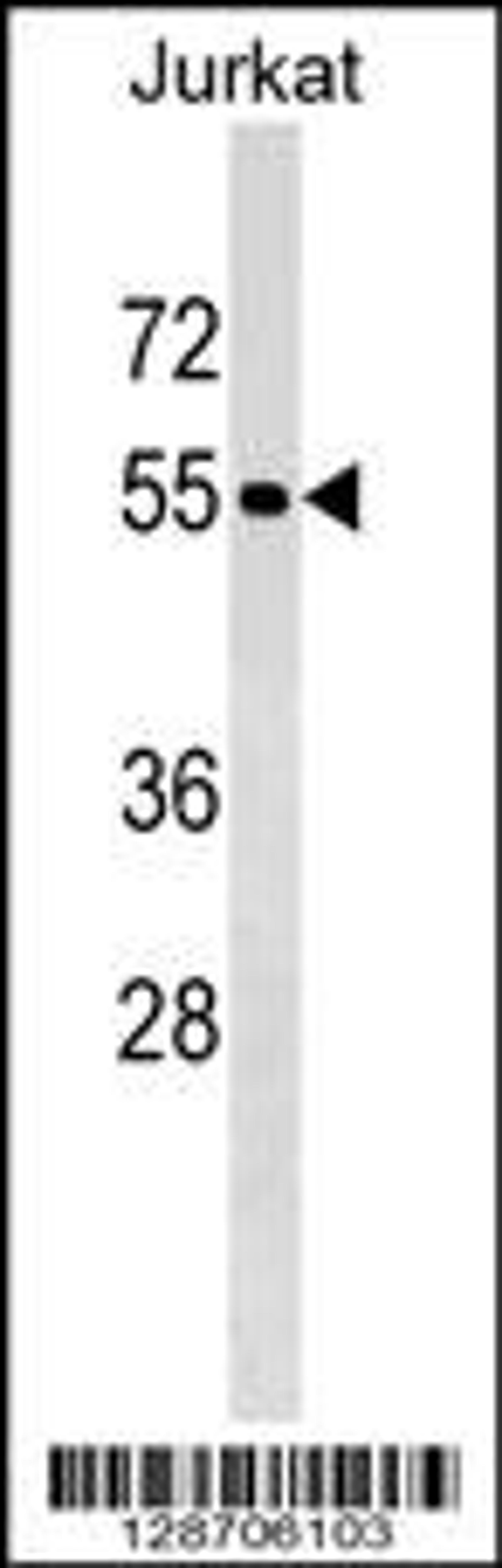 Western blot analysis in Jurkat cell line lysates (35ug/lane).