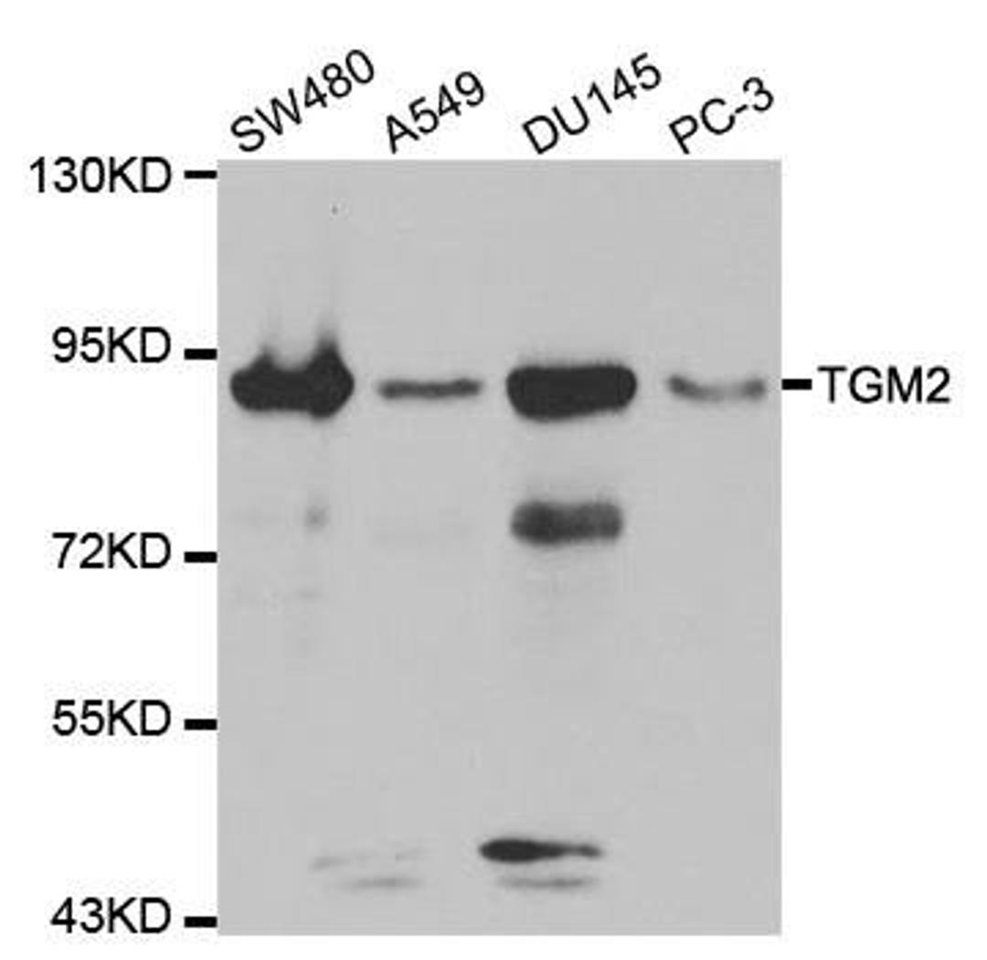 Western blot analysis of extracts of various cell lines using TGM2 antibody