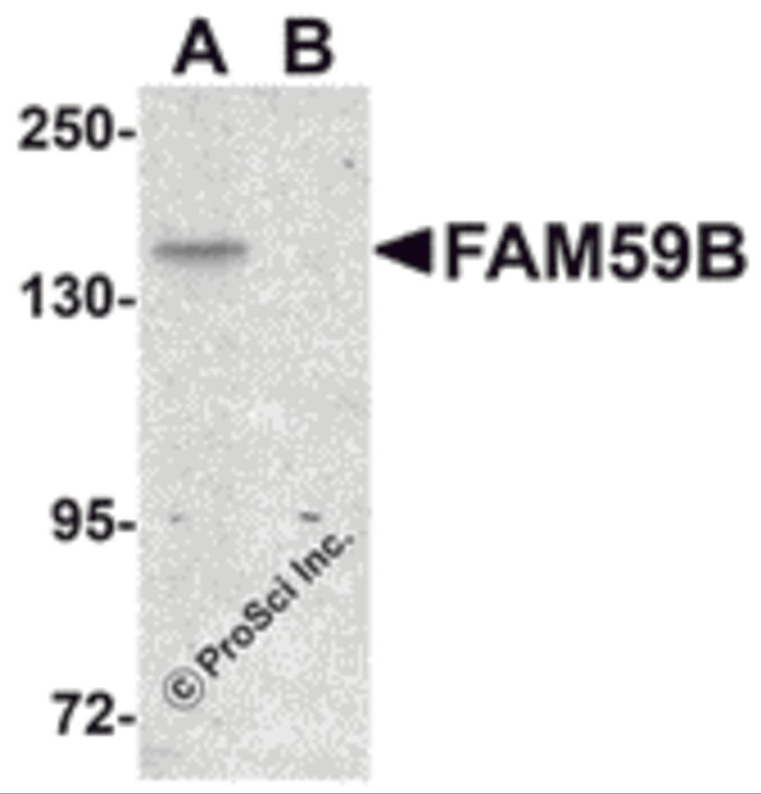 Western blot analysis of FAM59B in SK-N-SH cell lysate with FAM59B antibody at 1 μg/mL in (A) the absence and (B) the presence of blocking peptide.