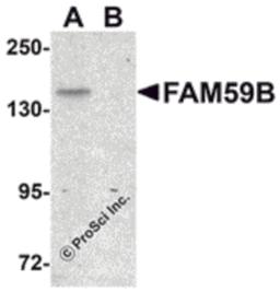 Western blot analysis of FAM59B in SK-N-SH cell lysate with FAM59B antibody at 1 μg/mL in (A) the absence and (B) the presence of blocking peptide.