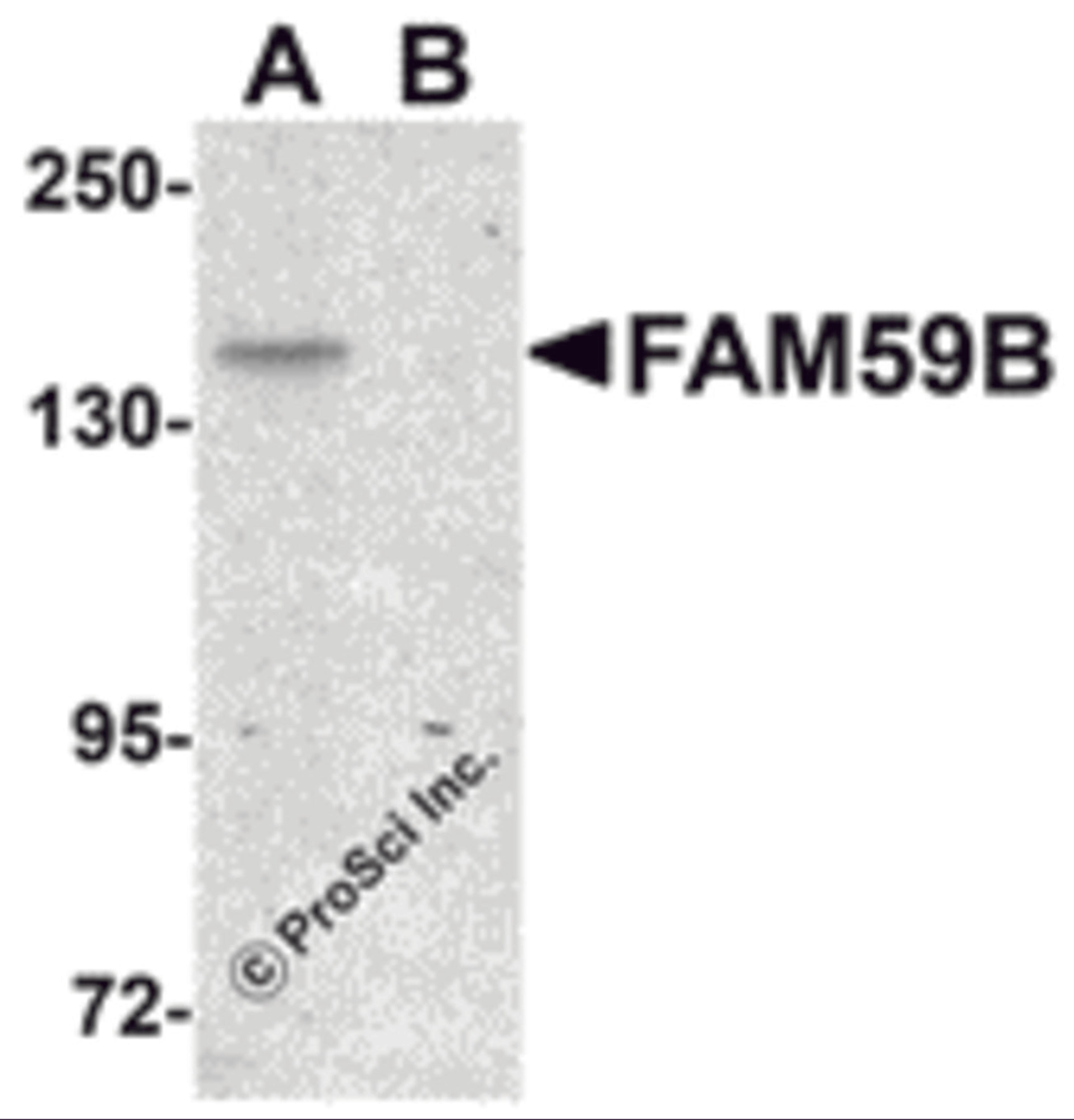 Western blot analysis of FAM59B in SK-N-SH cell lysate with FAM59B antibody at 1 μg/mL in (A) the absence and (B) the presence of blocking peptide.