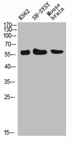 Western Blot analysis of K562 SH-SY5Y mouse-brain cells using E-Selectin Polyclonal Antibody diluted at 1:500. Secondary antibody was diluted at 1:20000