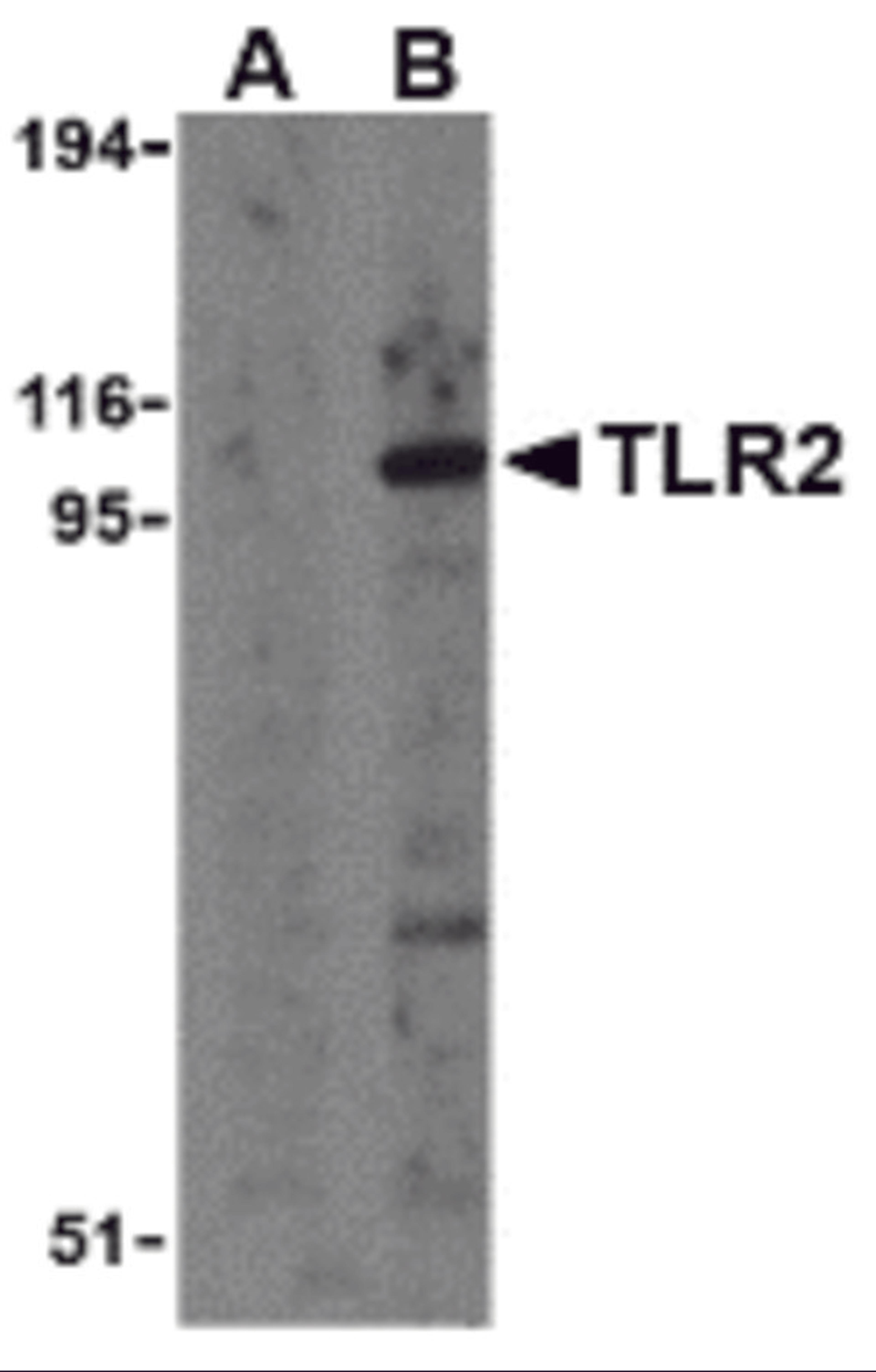 Western blot analysis of TLR2 in A20 cell lysates with TLR2 antibody at 1 μg/mL in the presence (A) and absence (B) of its blocking peptide.