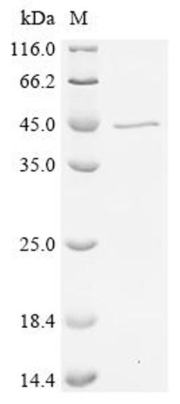 (Tris-Glycine gel) Discontinuous SDS-PAGE (reduced) with 5% enrichment gel and 15% separation gel.