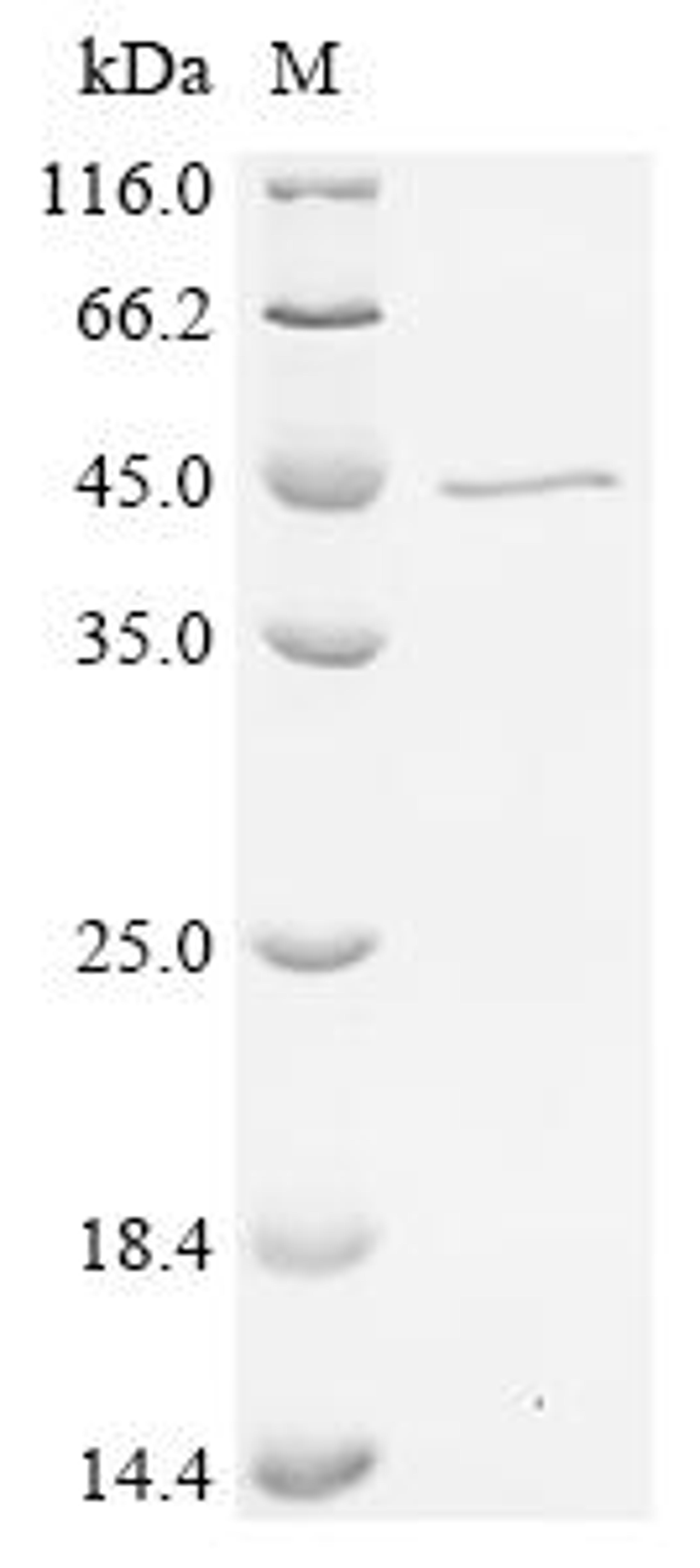 (Tris-Glycine gel) Discontinuous SDS-PAGE (reduced) with 5% enrichment gel and 15% separation gel.