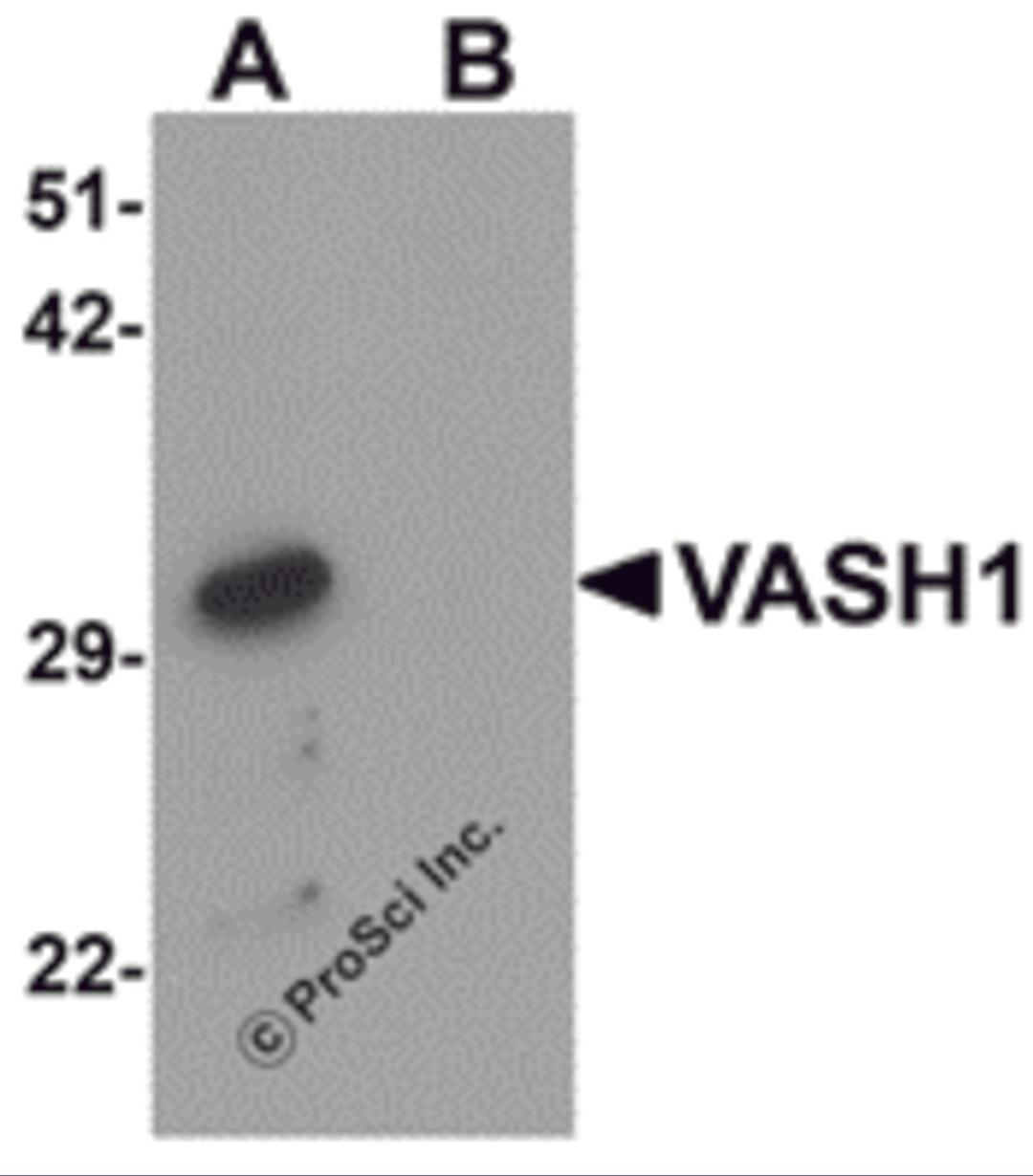 Western blot analysis of VASH1 in human brain tissue lysate with VASH1 antibody at 1 μg/mL in (A) the absence and (B) the presence of blocking peptide.
