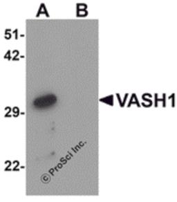 Western blot analysis of VASH1 in human brain tissue lysate with VASH1 antibody at 1 μg/mL in (A) the absence and (B) the presence of blocking peptide.