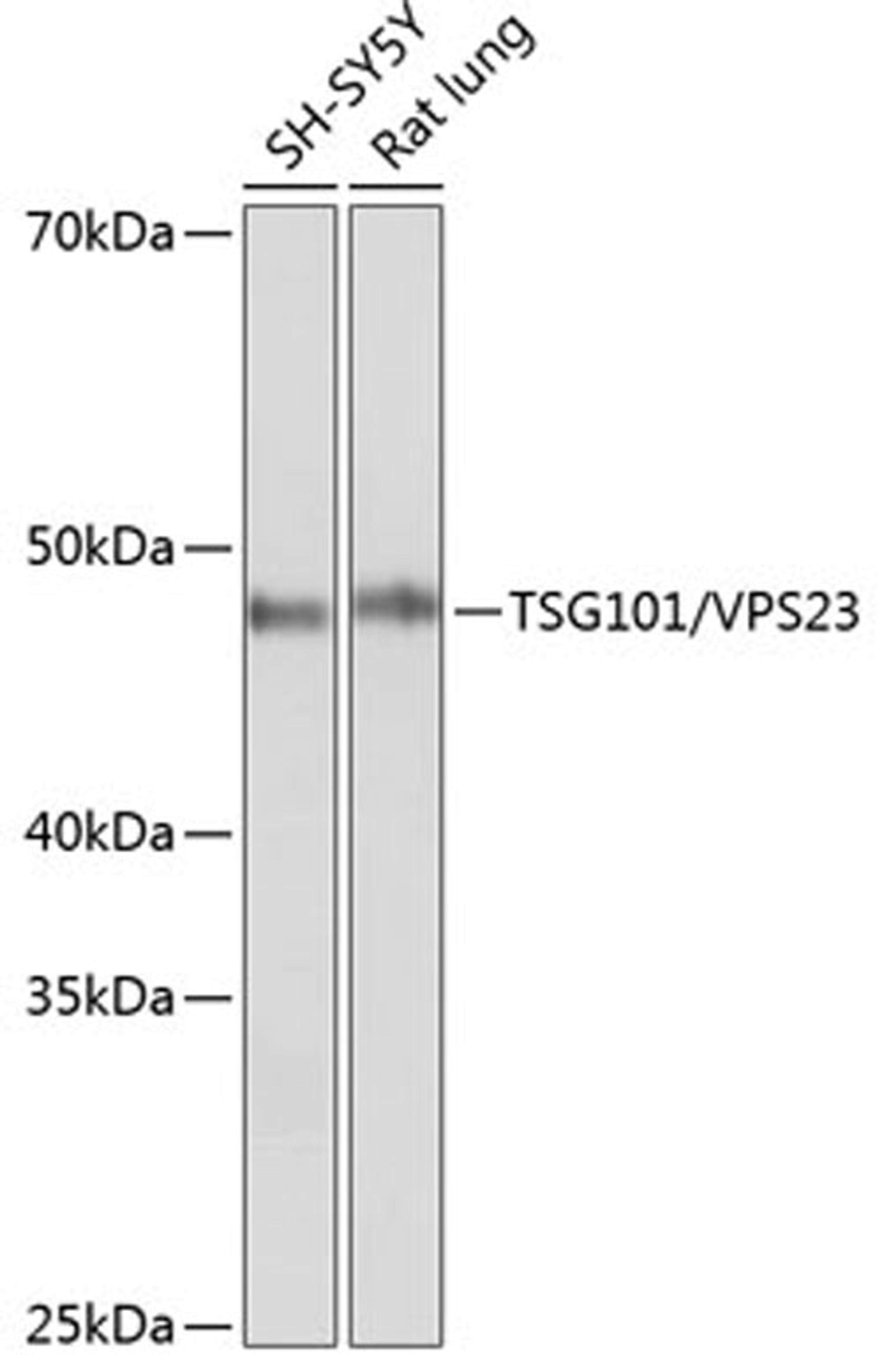 Western blot - TSG101 / VPS23 antibody (A5789)