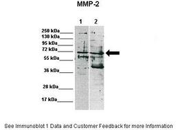 Antibody used in WB on Human at: 1:1000 (Lane 1: 15ug MDA-MB-231 lysate, Lane 2: 15ug MCF7 lysate).