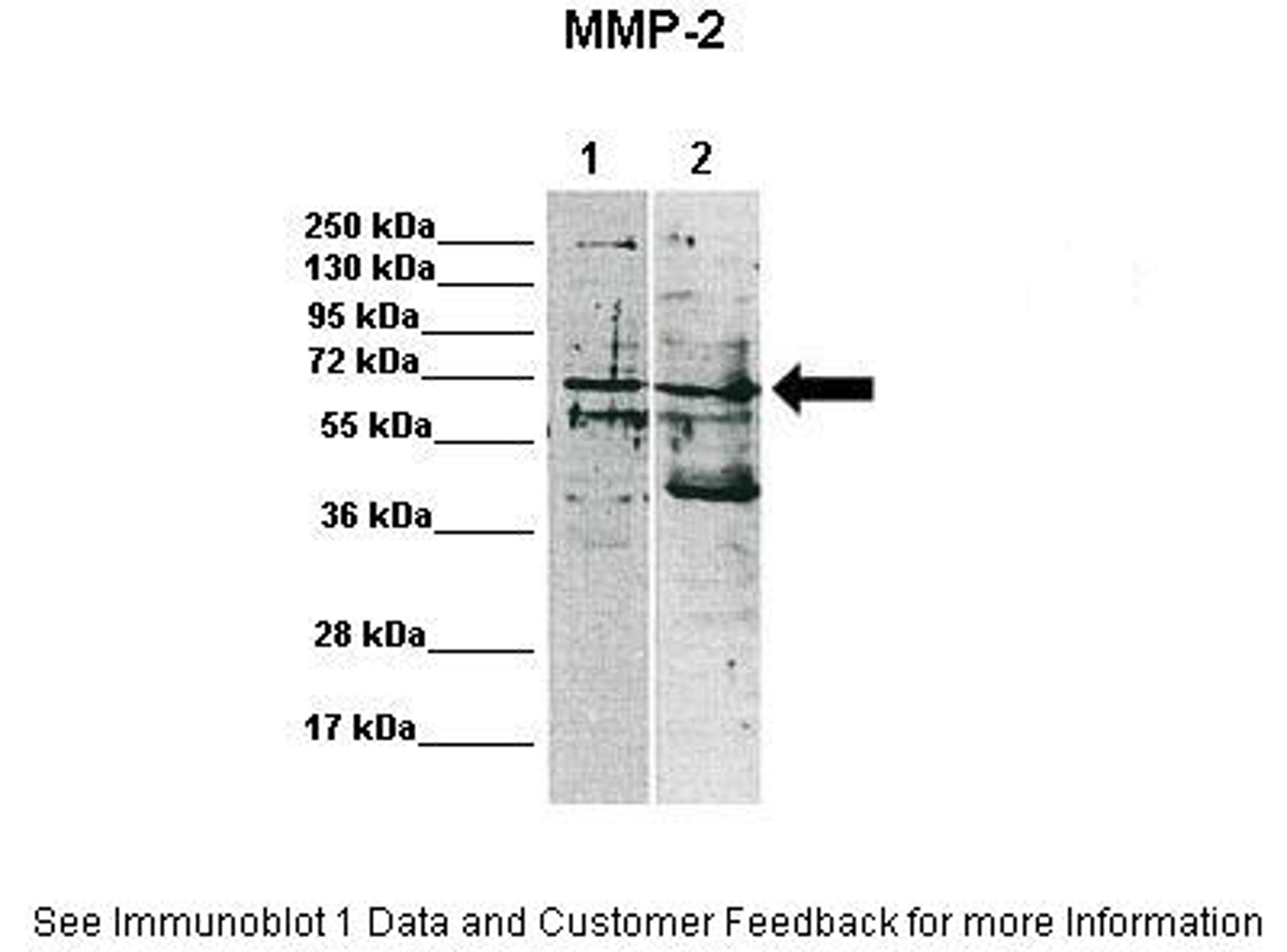 Antibody used in WB on Human at: 1:1000 (Lane 1: 15ug MDA-MB-231 lysate, Lane 2: 15ug MCF7 lysate).