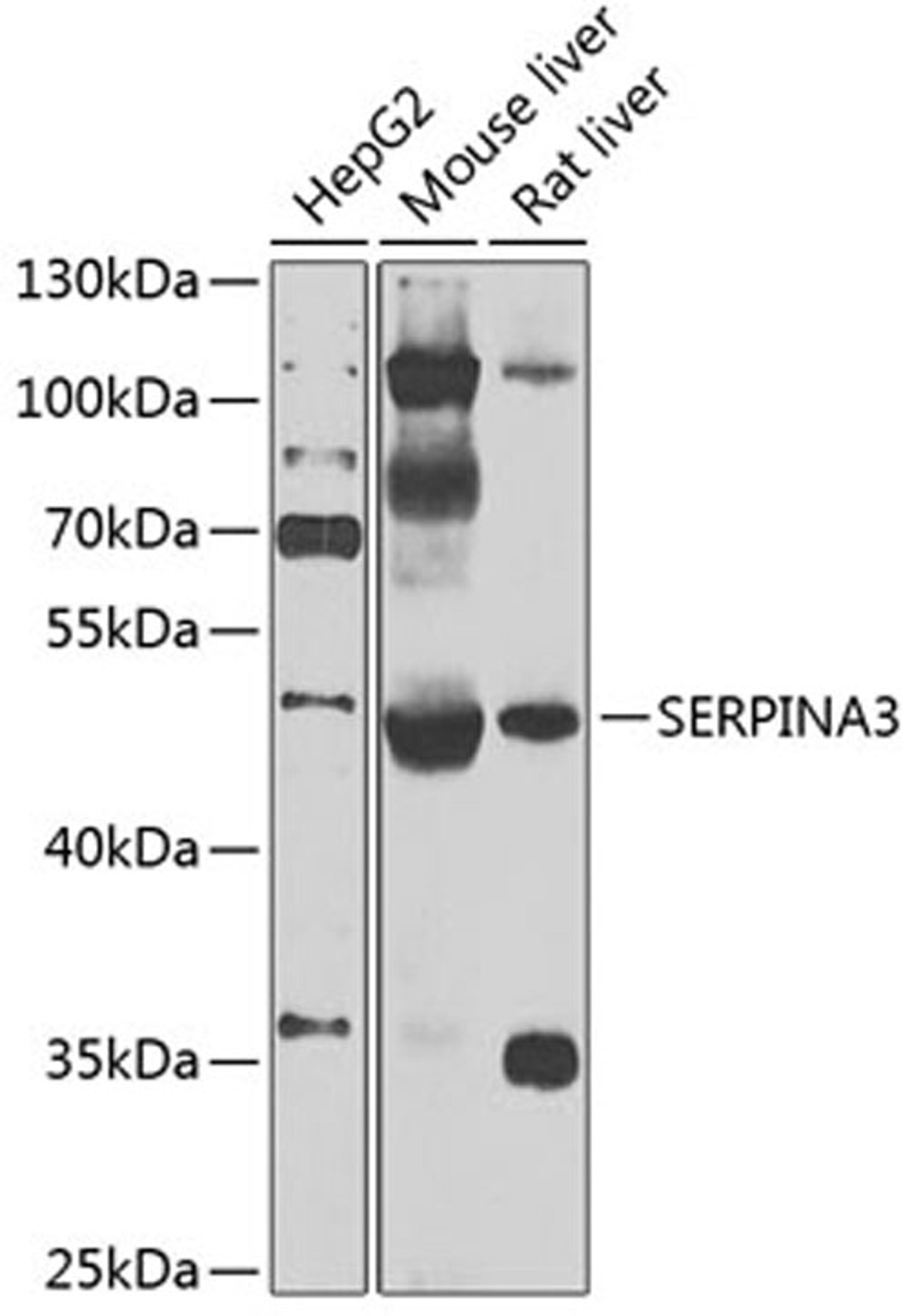 Western blot - SERPINA3 antibody (A2803)