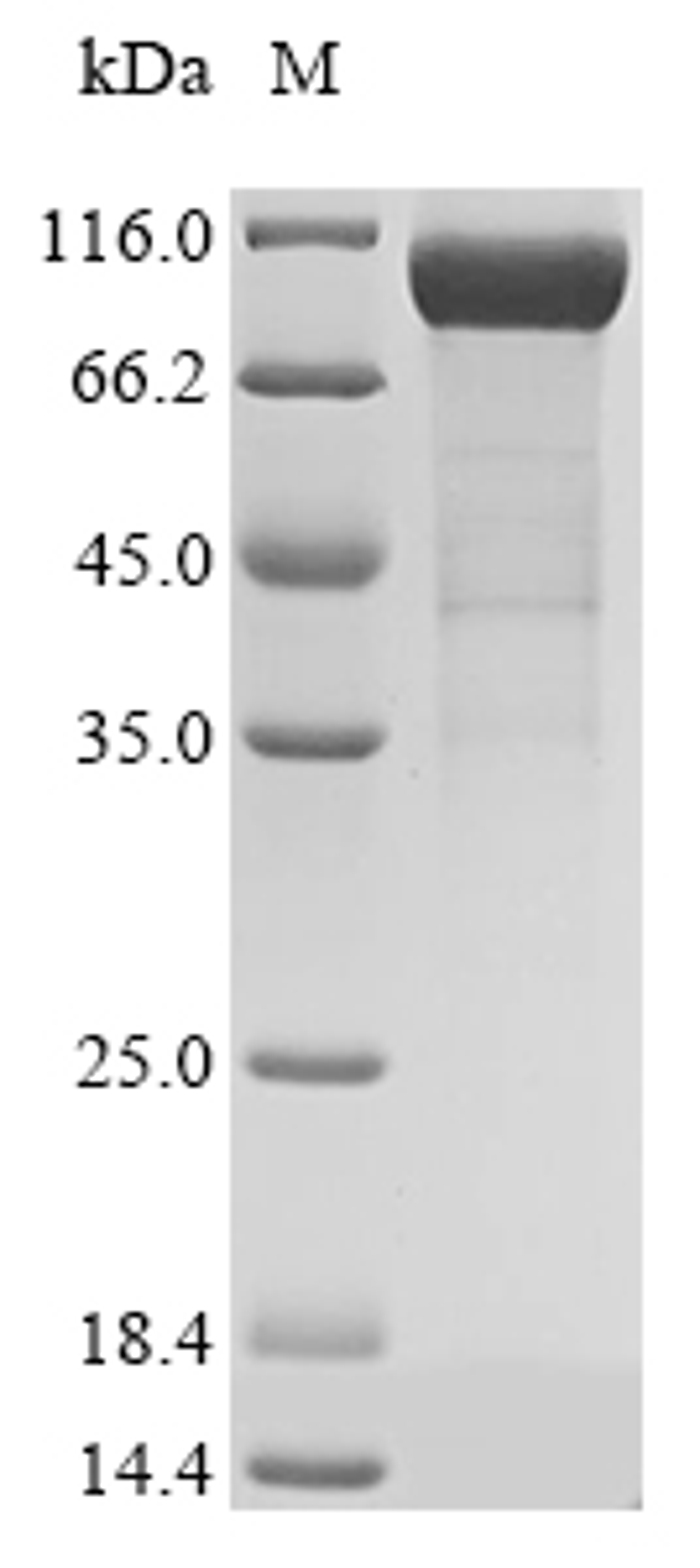 (Tris-Glycine gel) Discontinuous SDS-PAGE (reduced) with 5% enrichment gel and 15% separation gel.