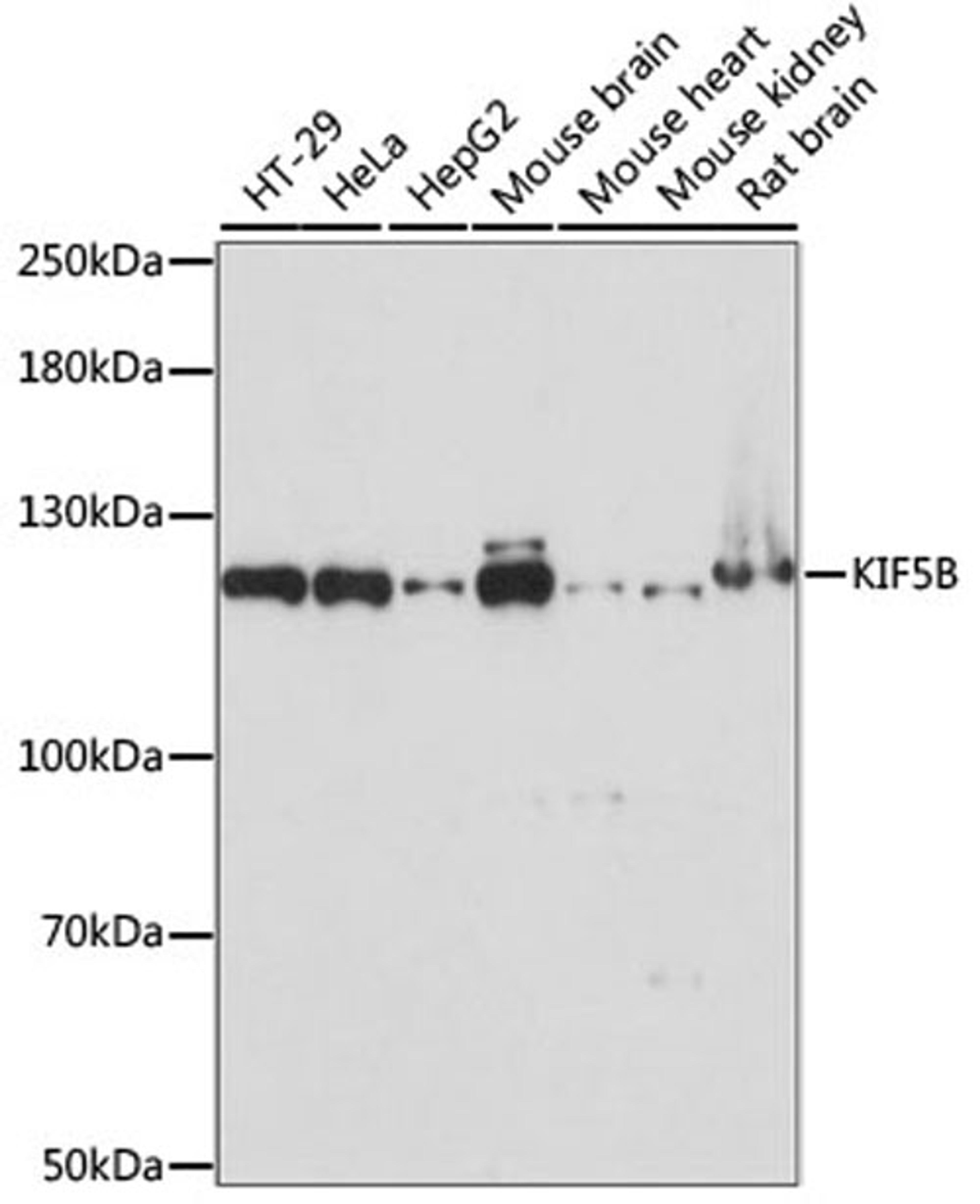 Western blot - KIF5B antibody (A15284)