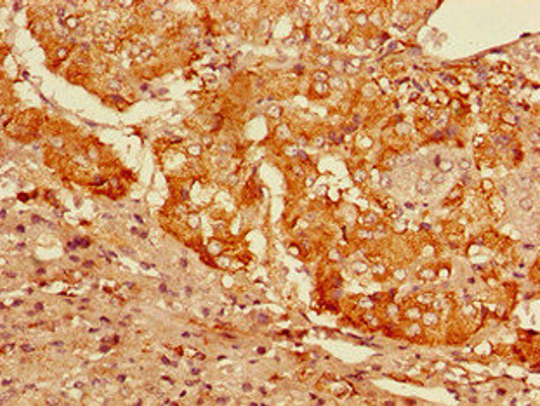 Immunohistochemistry of paraffin-embedded human adrenal gland tissue using CSB-PA009381LA01HU at dilution of 1:100