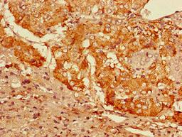 Immunohistochemistry of paraffin-embedded human adrenal gland tissue using CSB-PA009381LA01HU at dilution of 1:100
