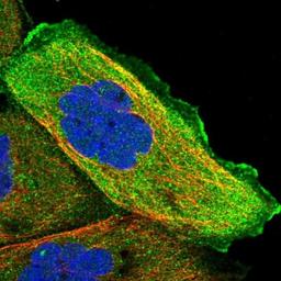 Immunocytochemistry/Immunofluorescence: FUNDC1 Antibody [NBP1-81063] - Staining of human cell line A-431 shows positivity in plasma membrane & cytoplasm.