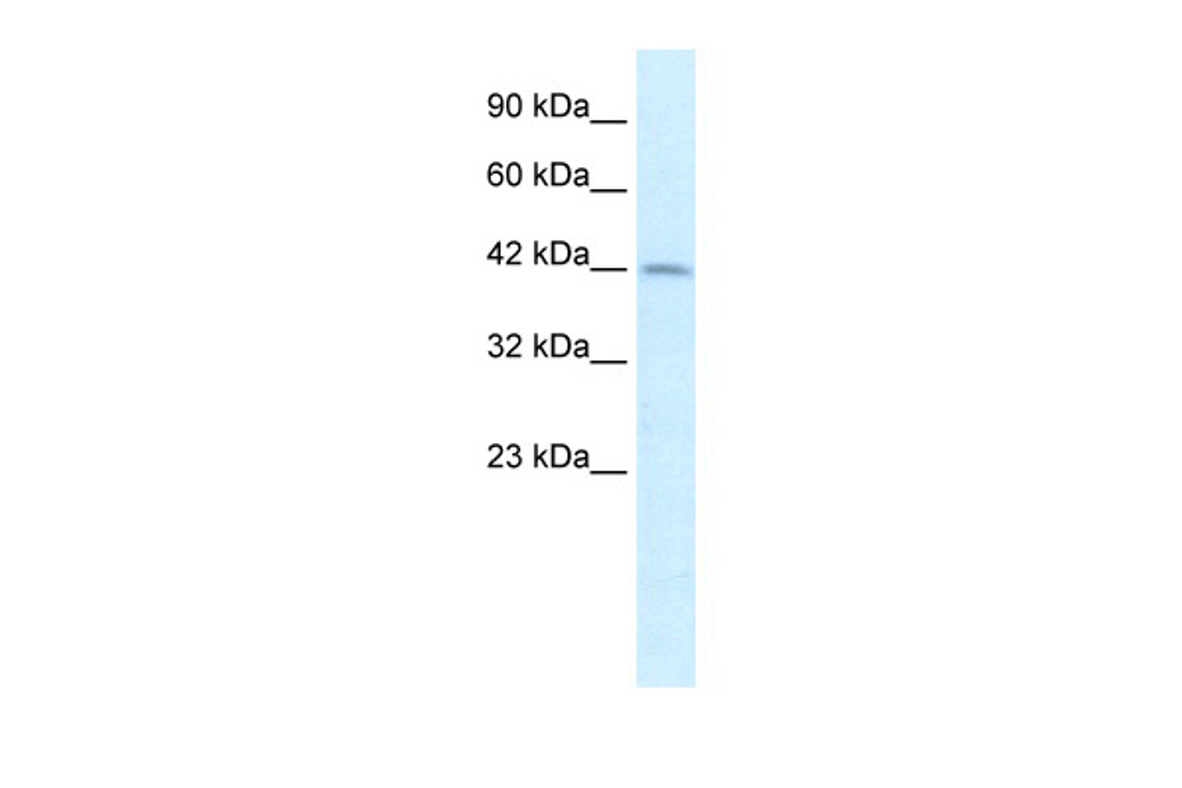 Antibody used in WB on Human Liver at 2.5 ug/ml.