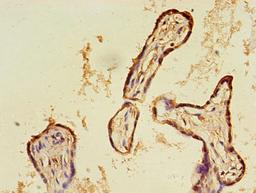 Immunohistochemistry of paraffin-embedded human placenta tissue using CSB-PA07867A0Rb at dilution of 1:100