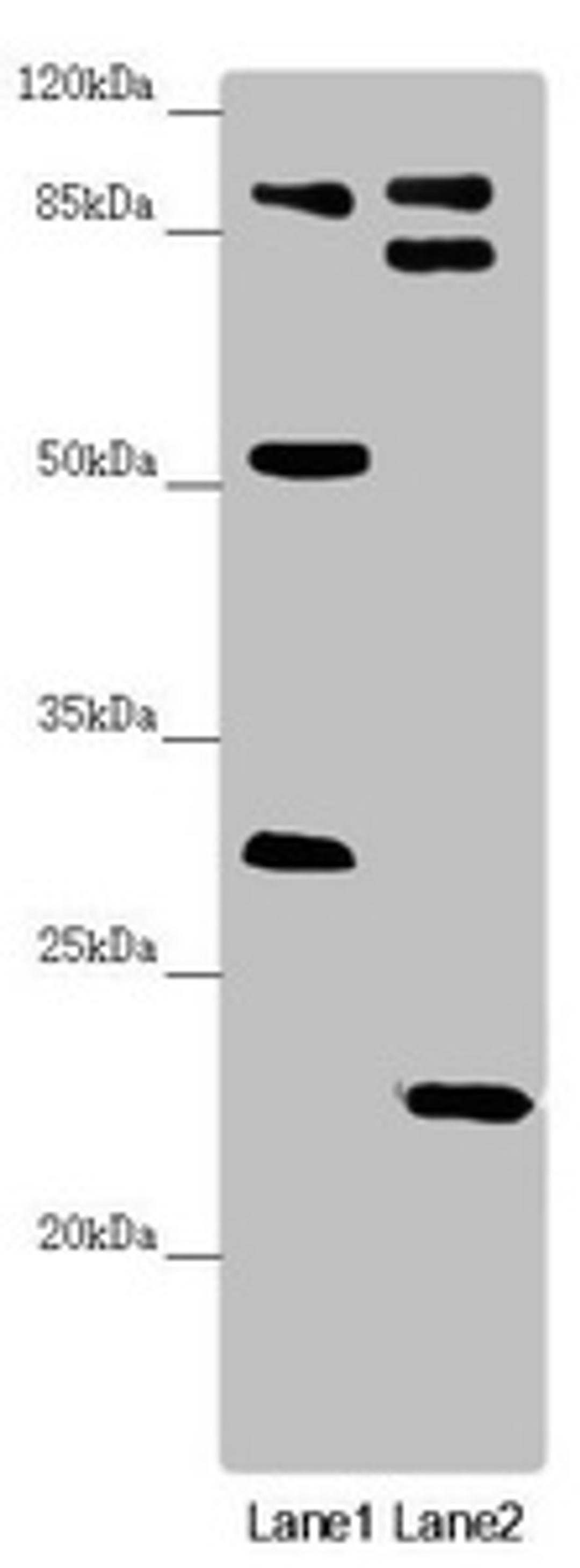 Western blot. All lanes: KANSL3 antibody at 1.68 ug/ml. Lane 1: U251 whole cell lysate. Lane 2: Mouse small intestine tissue. Secondary. Goat polyclonal to rabbit IgG at 1/10000 dilution. Predicted band size: 96, 84, 94, 81, 17, 59 kDa. Observed band size: 96, 83, 53, 31, 23 kDa. 