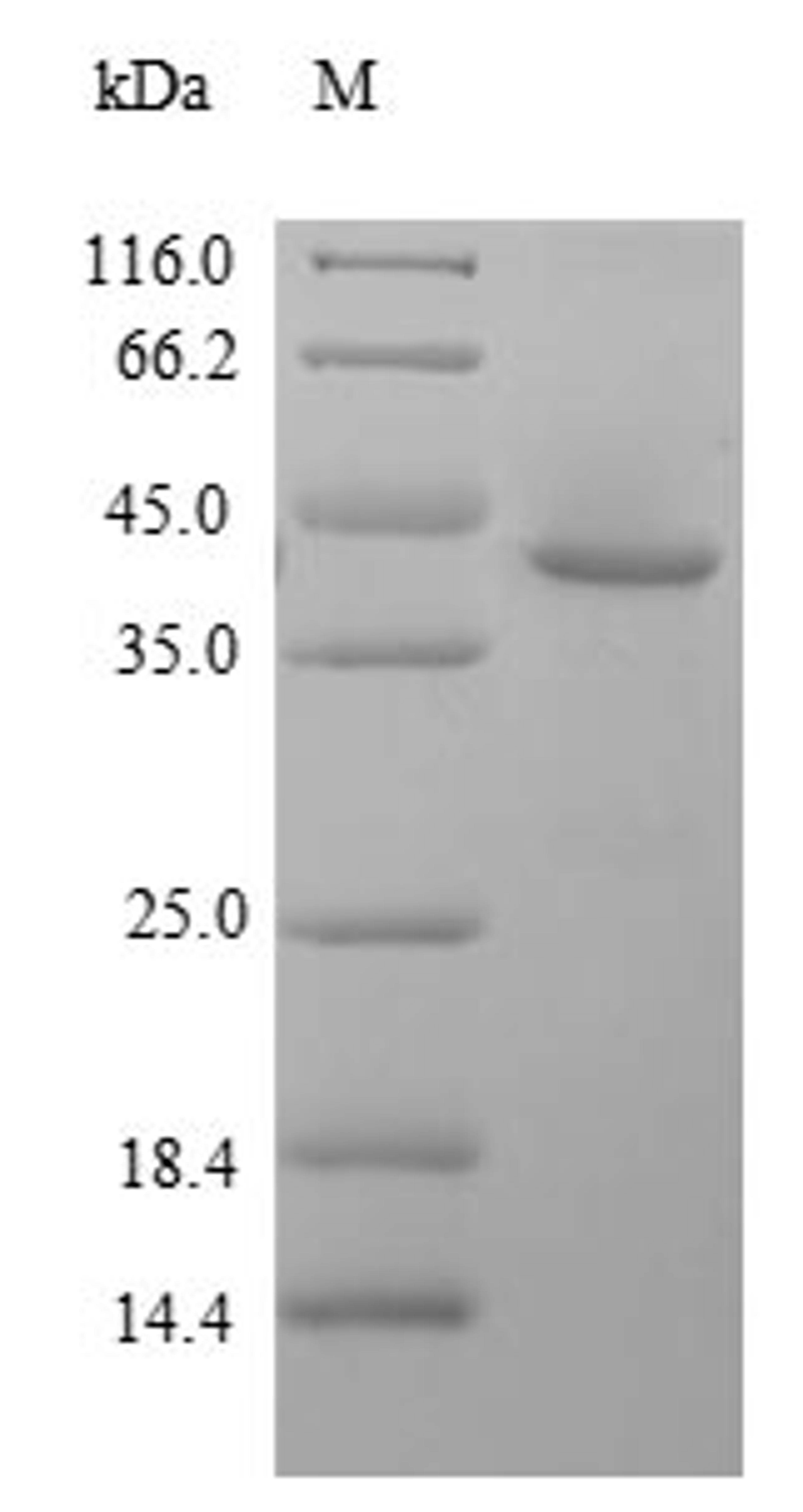 (Tris-Glycine gel) Discontinuous SDS-PAGE (reduced) with 5% enrichment gel and 15% separation gel.
