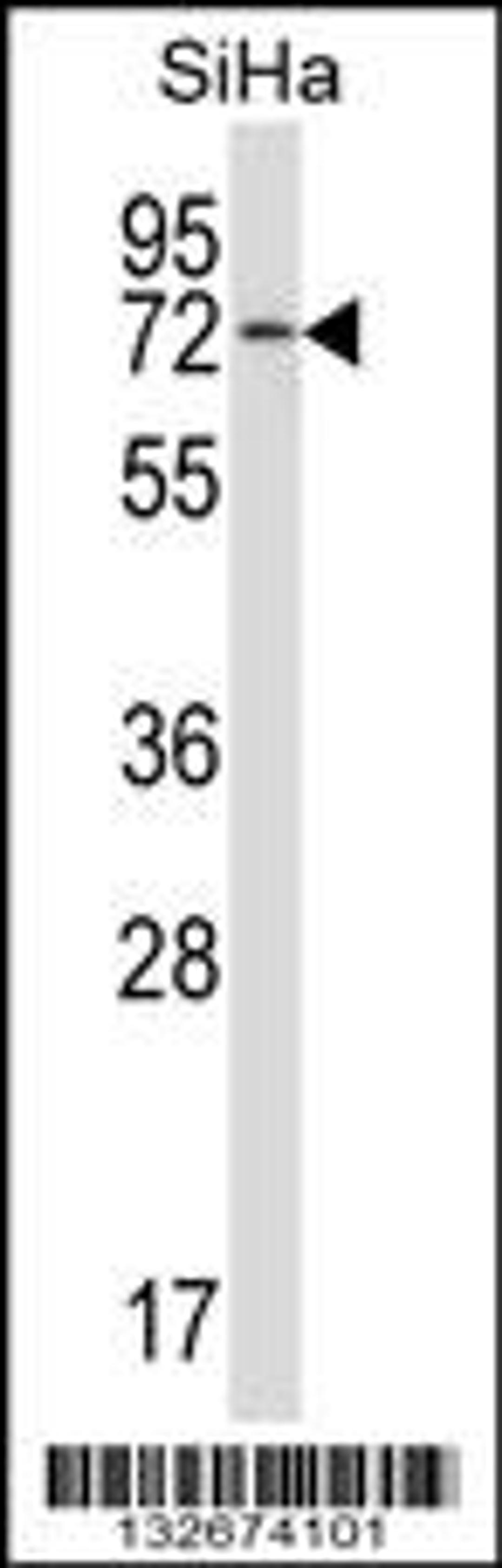 Western blot analysis in SiHa cell line lysates (35ug/lane).