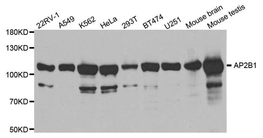 Western blot analysis of extracts of various cell lines using AP2B1 antibody