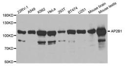 Western blot analysis of extracts of various cell lines using AP2B1 antibody