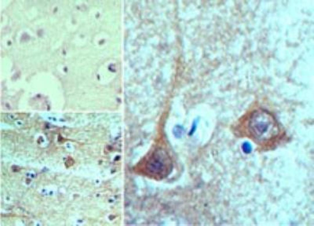 Immunohistochemistry-Paraffin: TBKBP1 Antibody [NBP2-24465] - Analysis of SINTBAD in paraffin-embedded formalin-fixed human brain tissue using an isotype control (top left) and this antibody (bottom left and right (100X)) at 5 ug/ml.