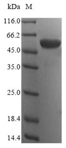 (Tris-Glycine gel) Discontinuous SDS-PAGE (reduced) with 5% enrichment gel and 15% separation gel.